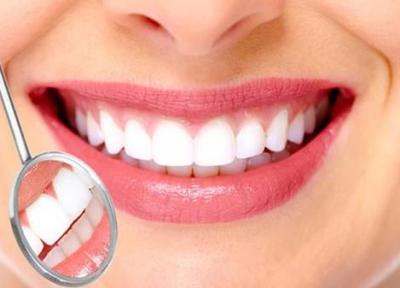 عمر لمینت دندان چقدر است؟ ، 8 راه حل اساسی برای افزایش ماندگاری لمینت